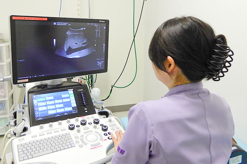 腹部エコー