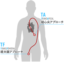 アプローチ説明図.jpg