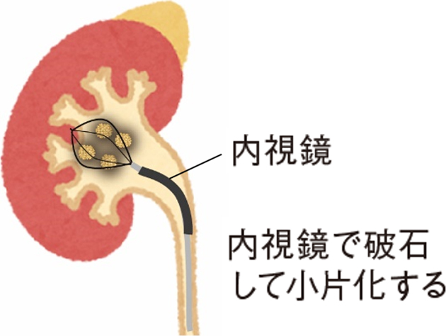 手術イメージ