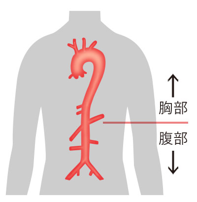 大動脈イラスト